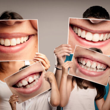 Family Dentist in Abbotsford
