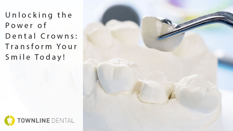 Unlocking the Power of Dental Crowns: Transform Your Smile Today!