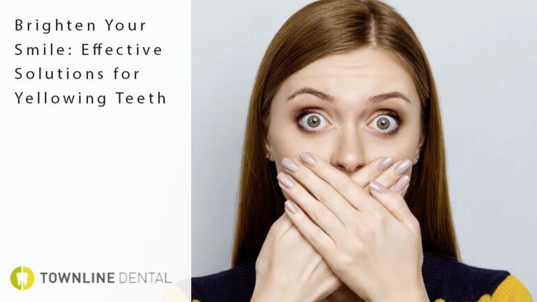 Brighten Your Smile: Effective Solutions for Yellowing Teeth